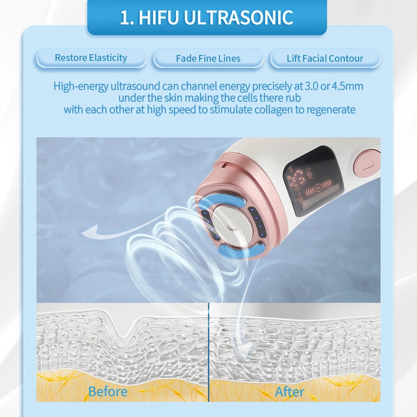 Mini HIFU Machine - Ultrasonic RF Face Lifting & Skin Tightening Device